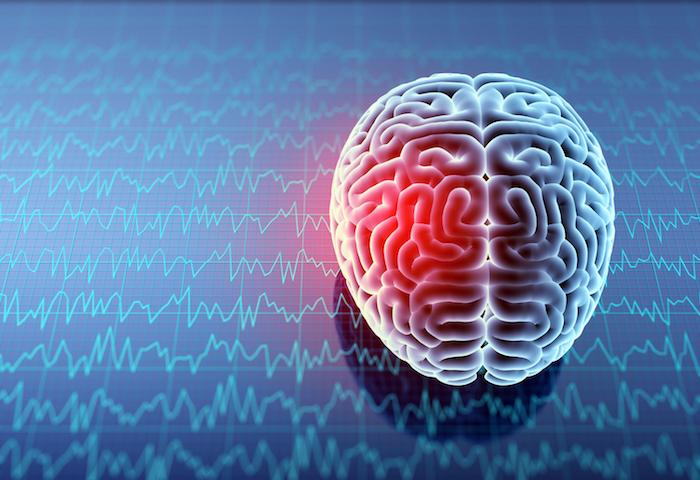 Mémoire Traumatique : Comprendre et Surmonter les Bugs mnésiques